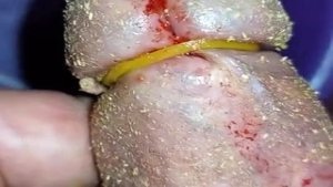 Cbt insertion bdsm pervers maggots